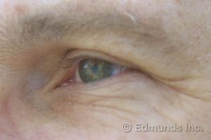 Eye Eye